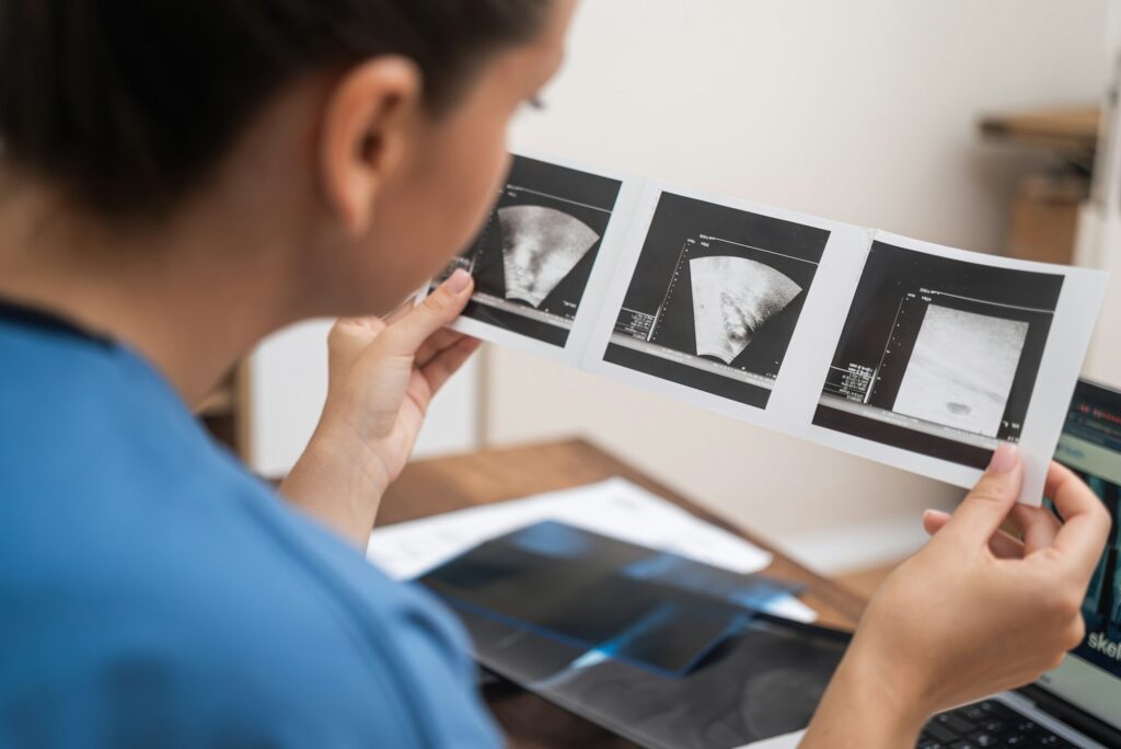 IVF Ultrasound Examination: close up doctor ultrasound results, recording notes on her laptop